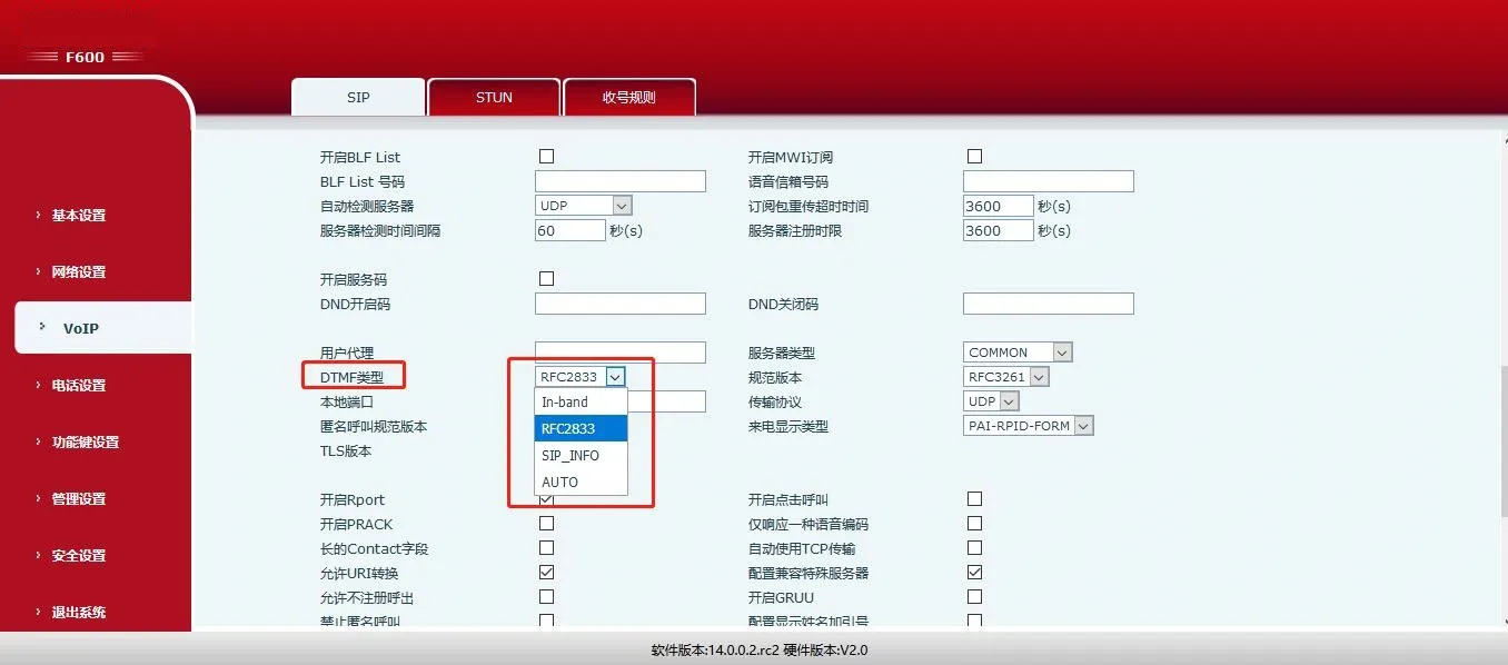 SIP 進階設定介面